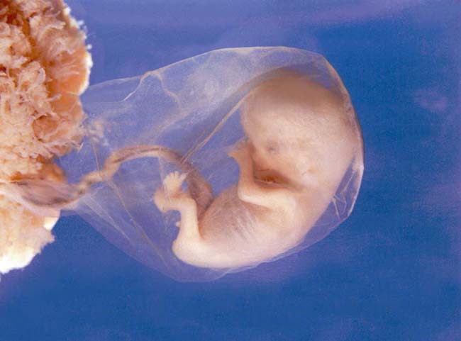 embryos at 5 weeks. embryos at 5 weeks