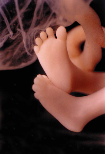 of aborted babies at some
