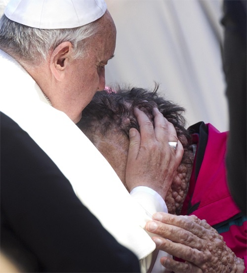 Pope_Francis_kisses_a_man_suffering_from_boils_in_Saint_Peters_Square_at_the_end_of_his_Wednesday_general_audience_Nov_6_2013_Credit_ANSA_CLAUDIO_PERI_CNA_11_6_13